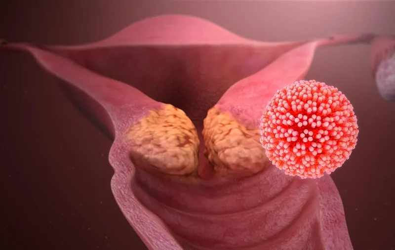 hpv la benh gi dau hieu nhan biet va bien chung nguy hiem