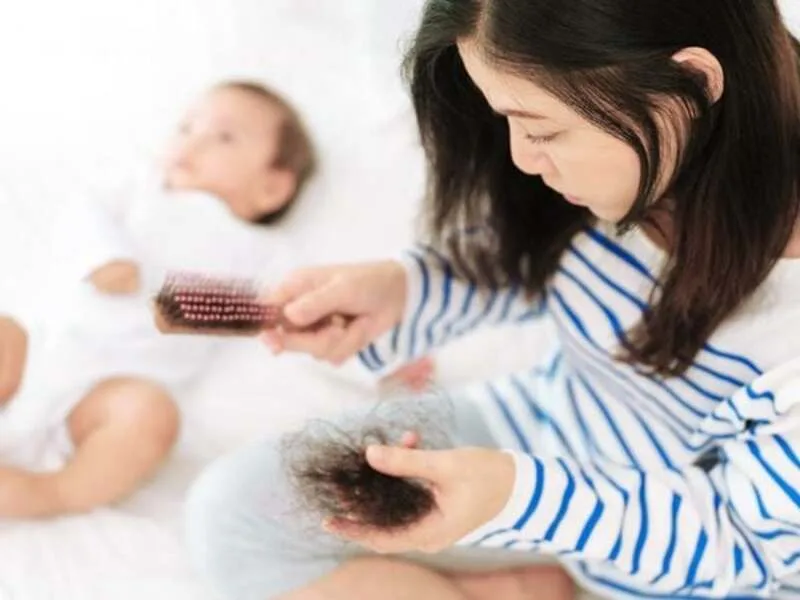 Phụ nữ sau sinh có thể gặp rụng tóc do thay đổi nội tiết và cần chăm sóc kiên nhẫn.