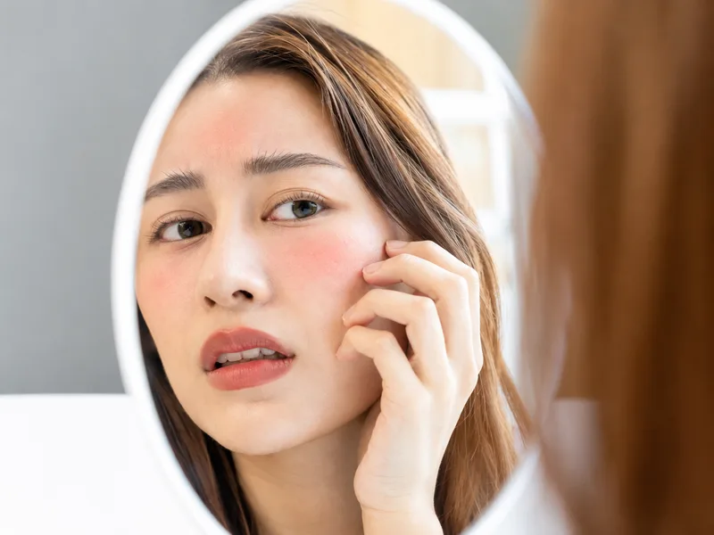 Người có da nhạy cảm, tổn thương hoặc đang viêm nên thận trọng khi tẩy tế bào chết bằng bã cà phê